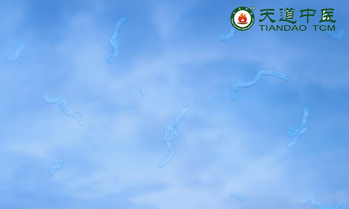 飞蚊症