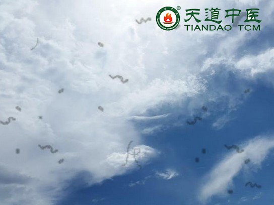 飞蚊症